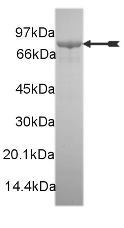 Eurofins DiscoverX MKK6/SKK3 (S599D, T603D) Protein, Active 10 &mu;g | Buy Online | Eurofins DiscoverX | Fisher Scientific